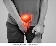 Cancer de la prostate : le dépistage précoce recommandé aux hommes